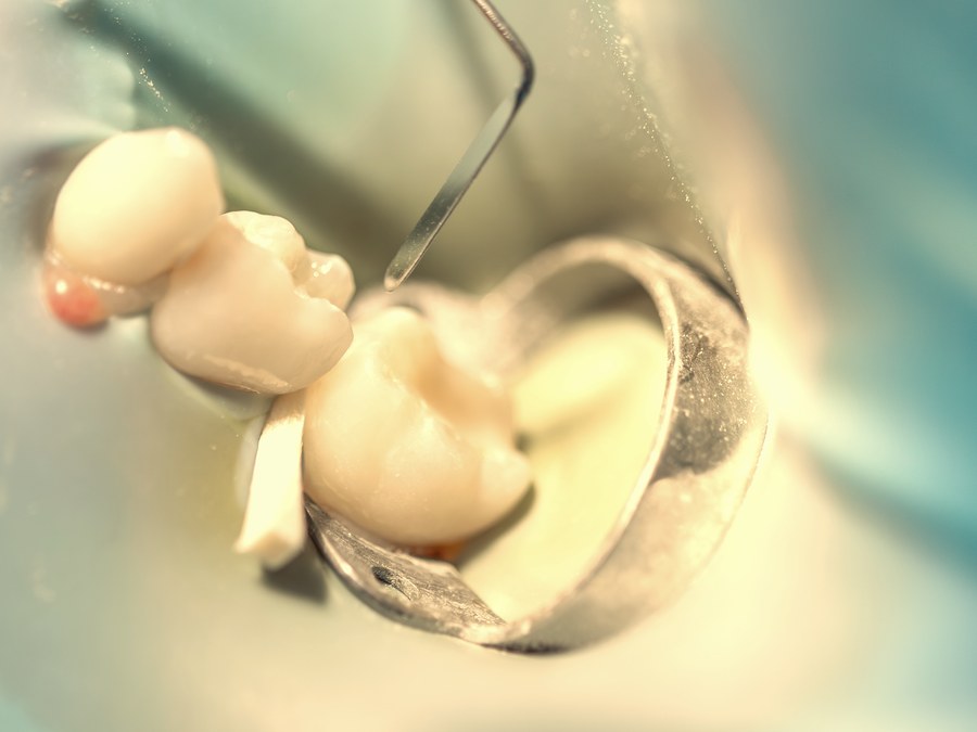 Endodontia · Canal — Yamaguti Odontologia, Santo André